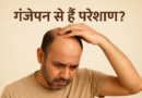 गंजापन