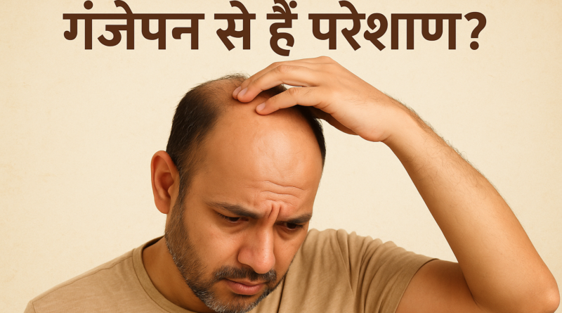 गंजापन